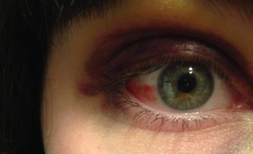 Image uploaded by Michelle