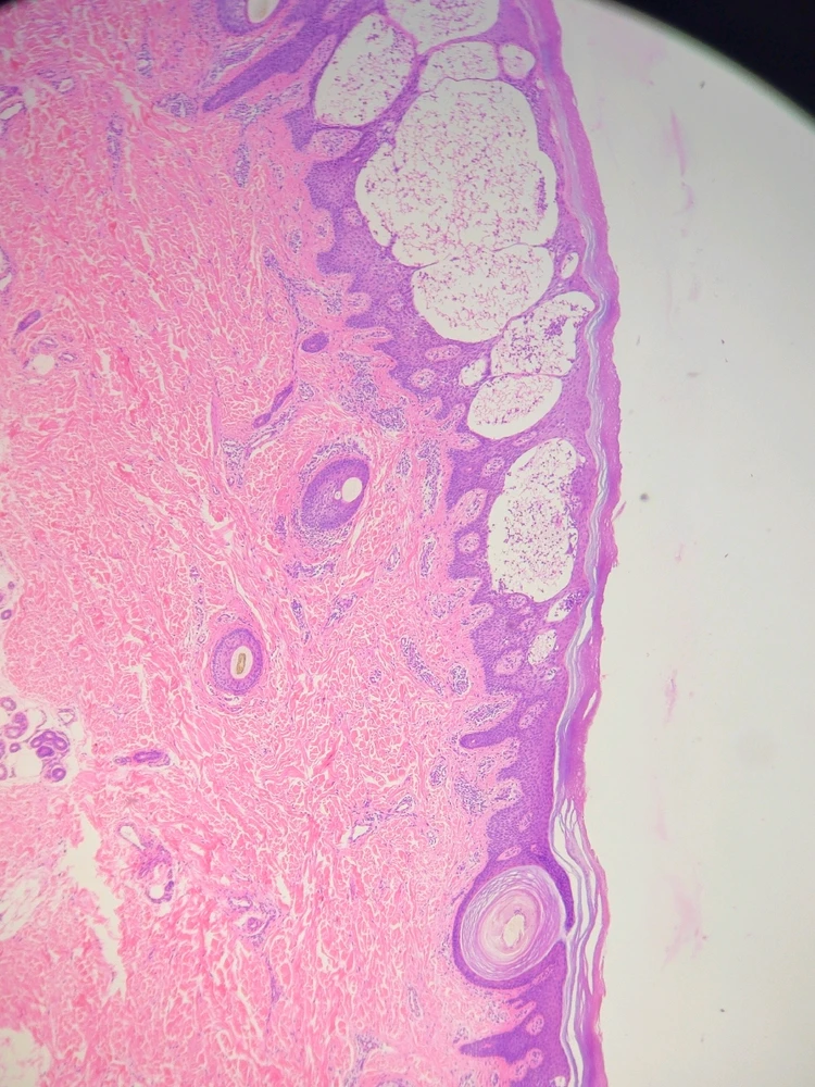 Image uploaded by Veg