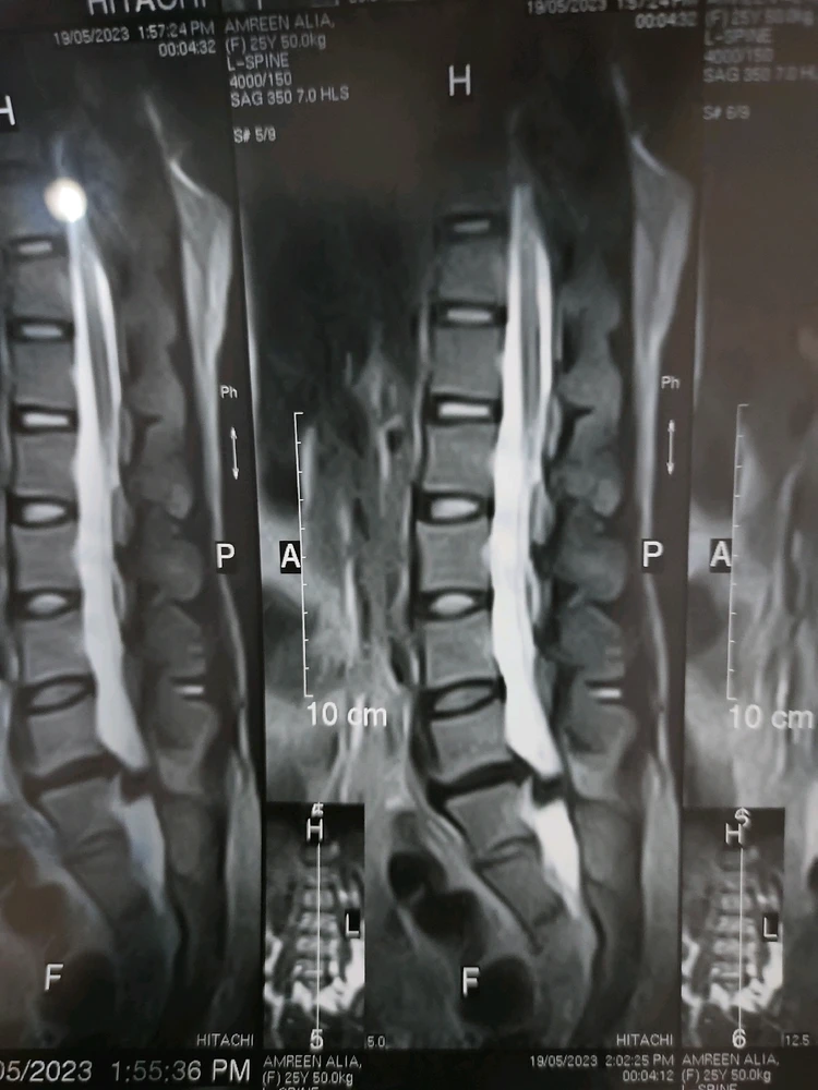 Image uploaded by Dr saam