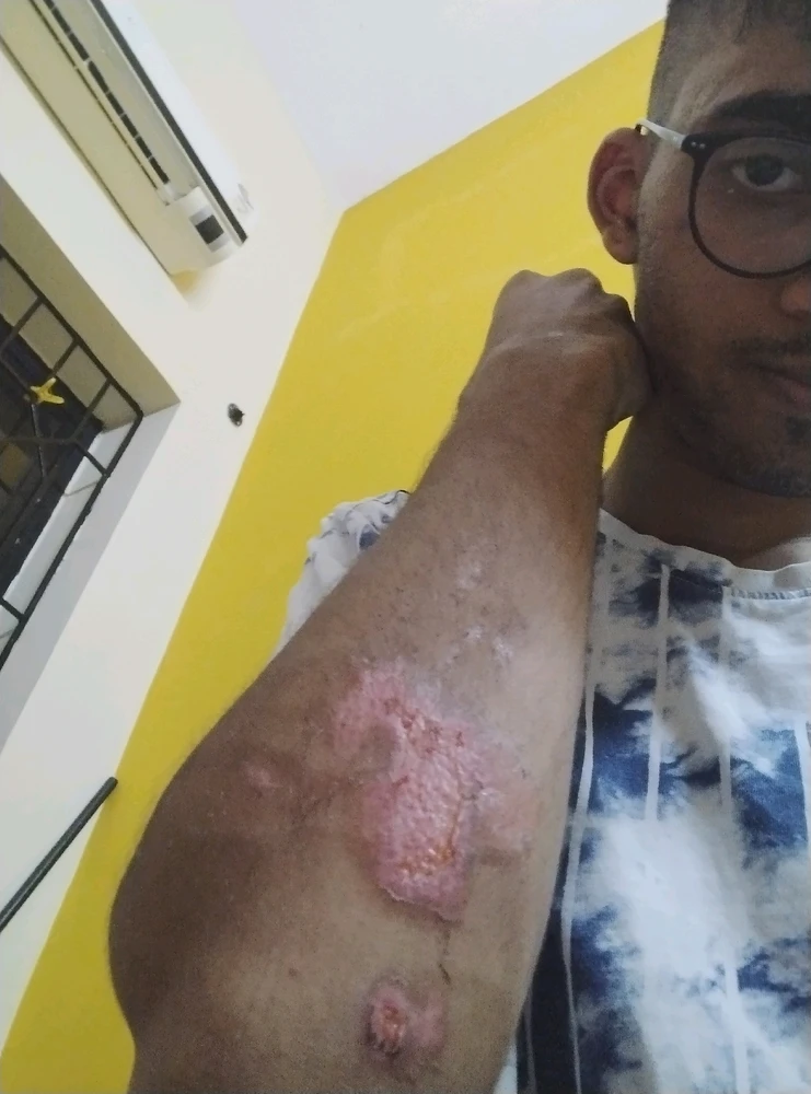 Image uploaded by Chinmay