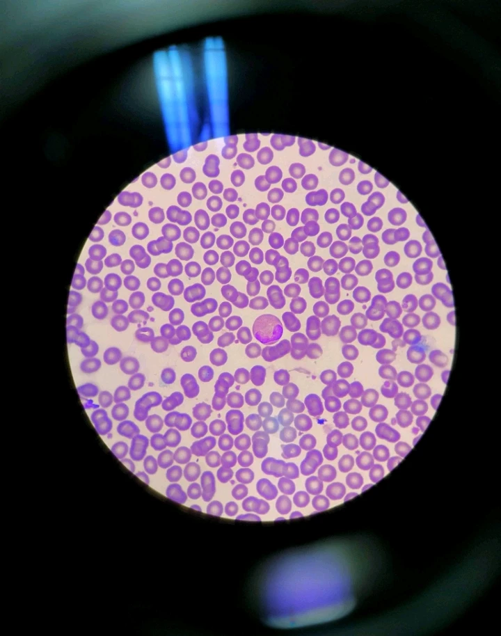 Image uploaded by Ems