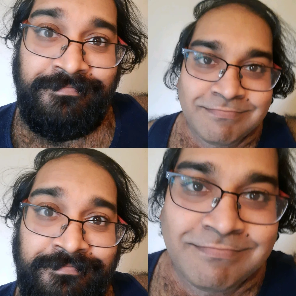Before & After