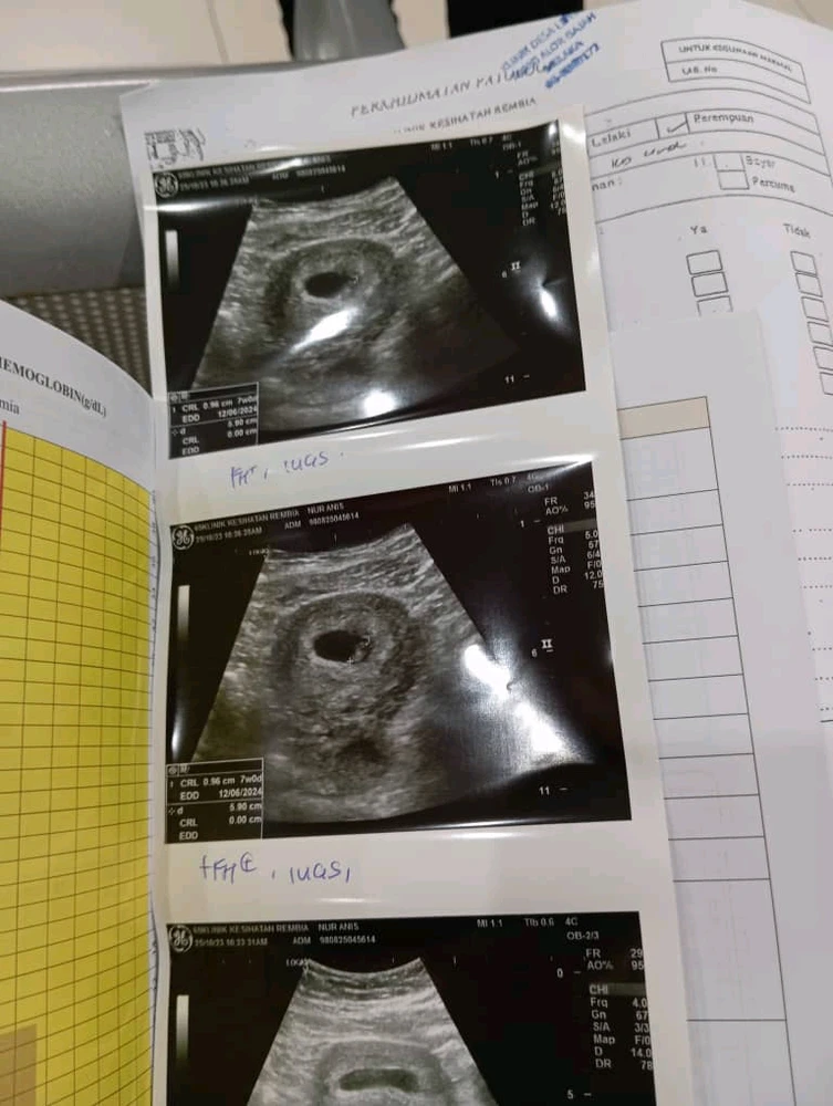 Image uploaded by Hana