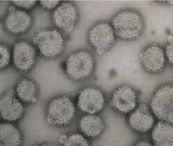 【悲報】Influenza