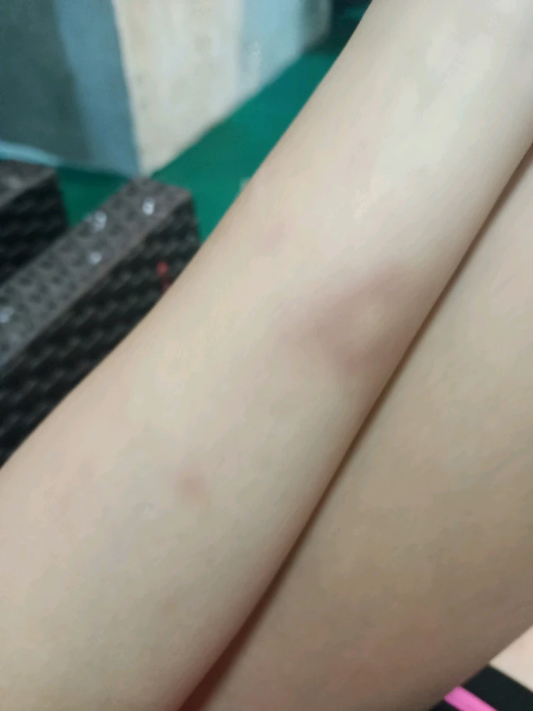 Image uploaded by cae