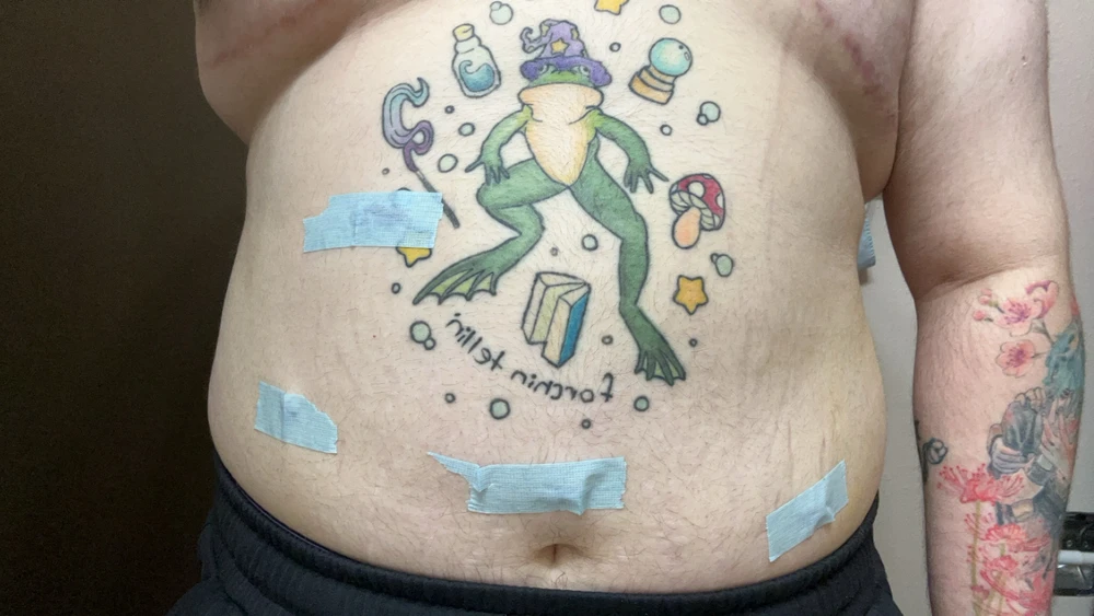 4 out 5 incisions from my surgery! 