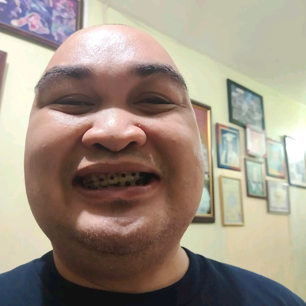 Image uploaded by John eley Louis castillo