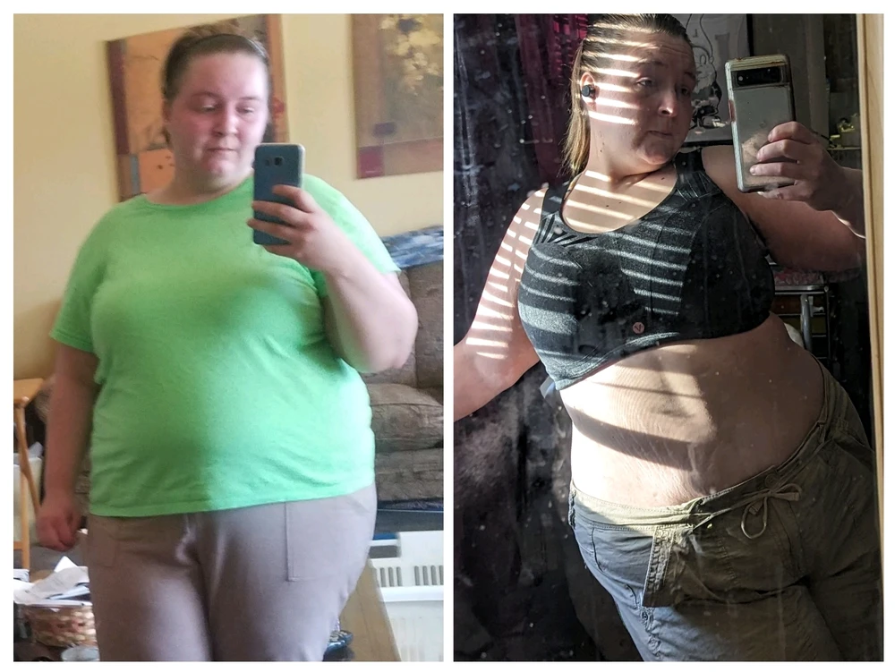 Left Photo: August 2018
Right Photo: March 2024