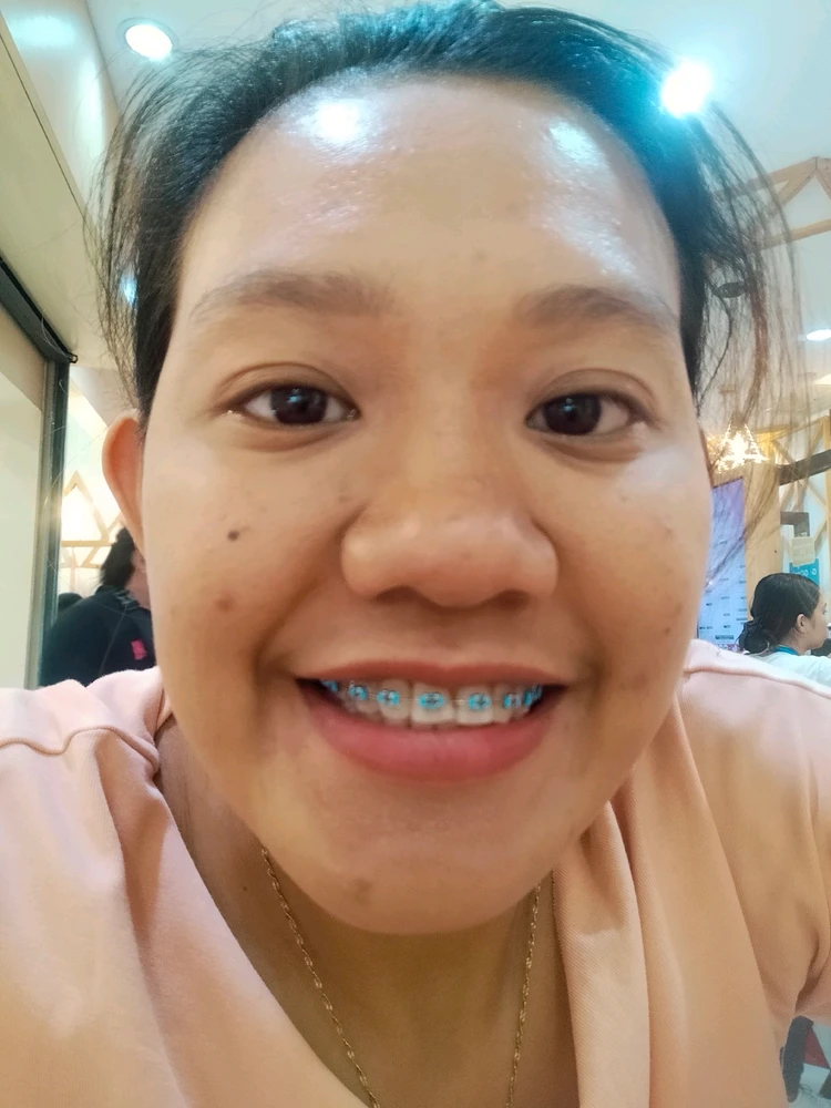 Gi-upload ni Vicon ang hulagway