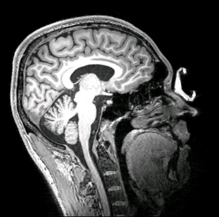 Image uploaded by Adam