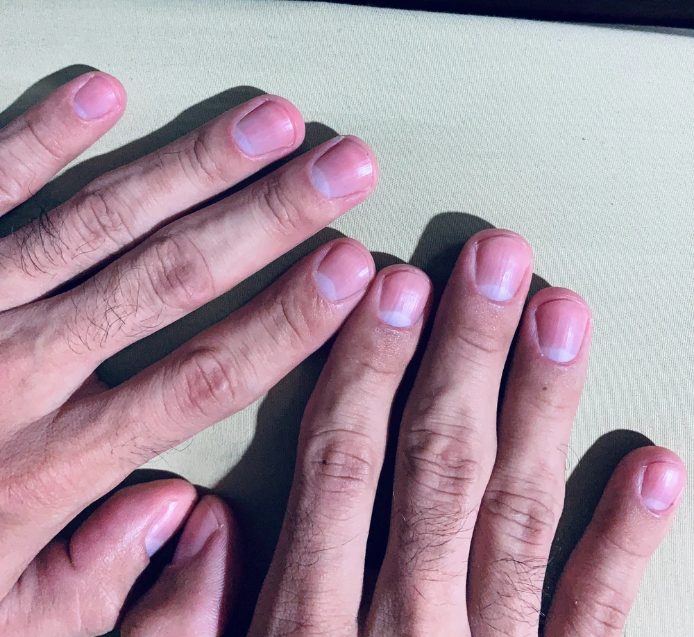 Imagen subida por Franz Matamoros