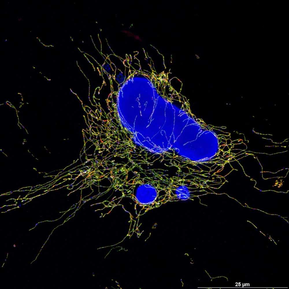 Image uploaded by Stanis