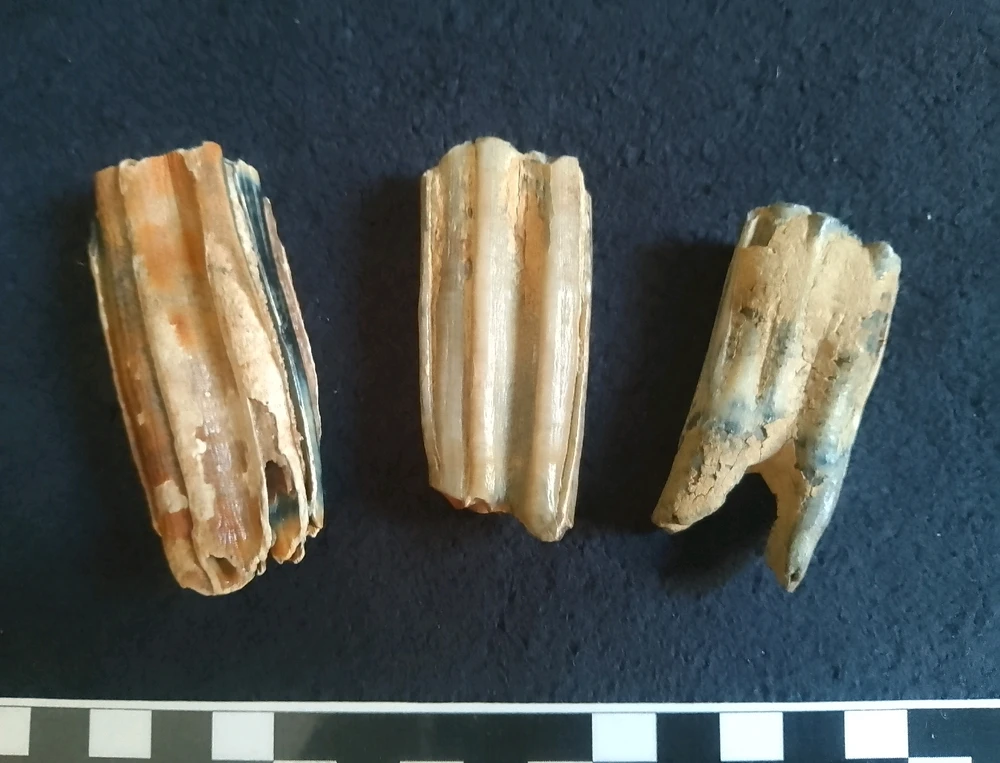 Zähne vom Niederrhein