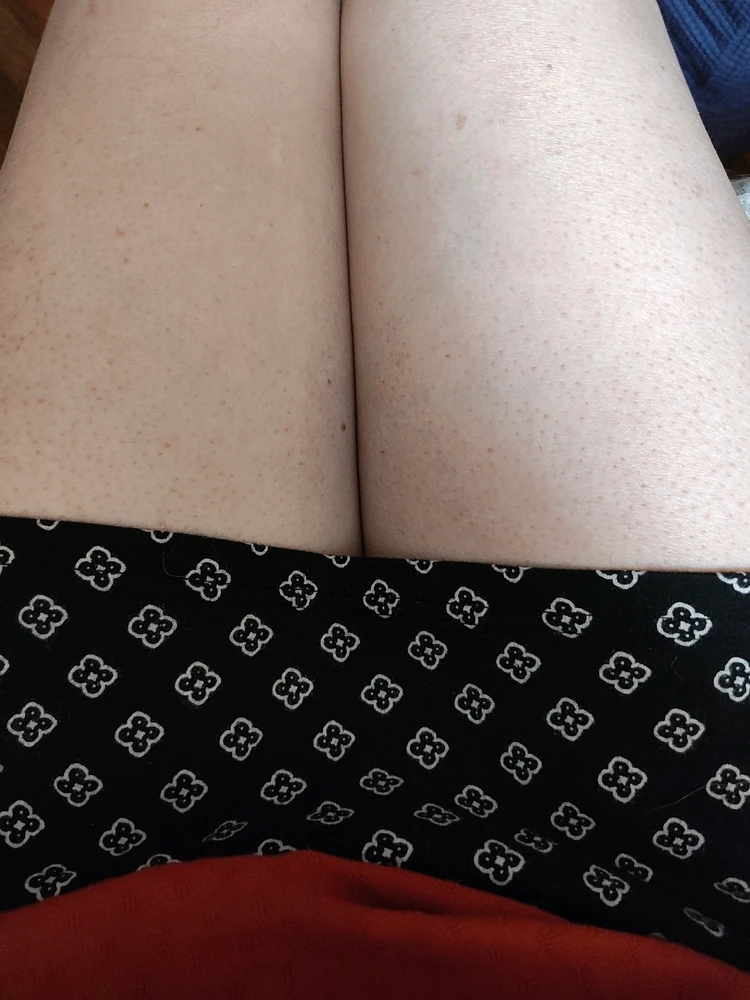 Image uploaded by Billie