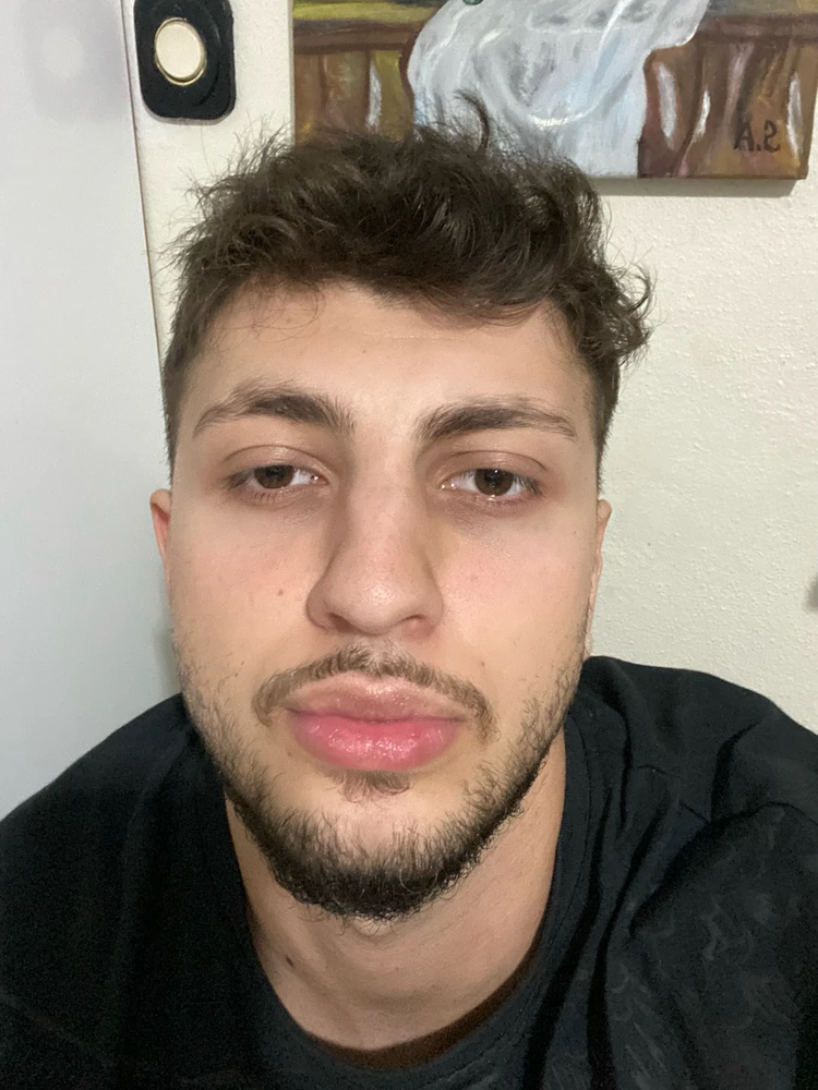 Çağrı tarafından yüklenen GIF