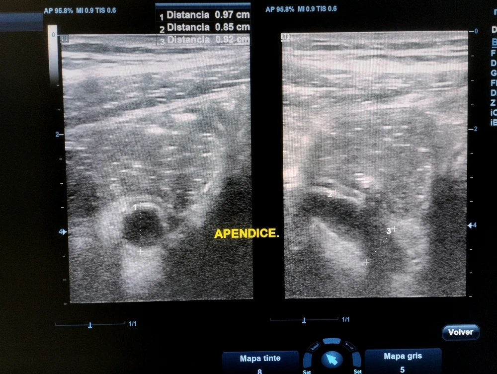 GIF subido por Gerardo