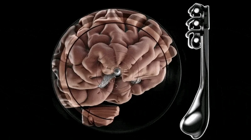 GIF uploaded by Chaitanya Vernekar