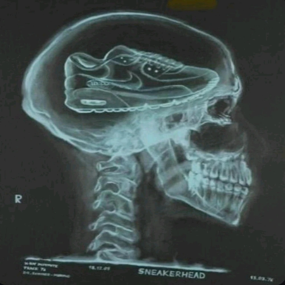 Bence által feltöltött kép