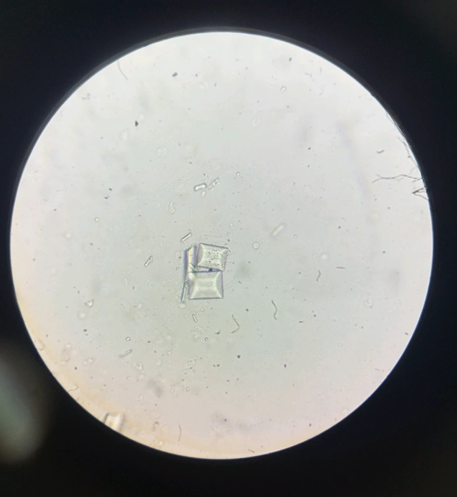 Cristales de orina alcalina