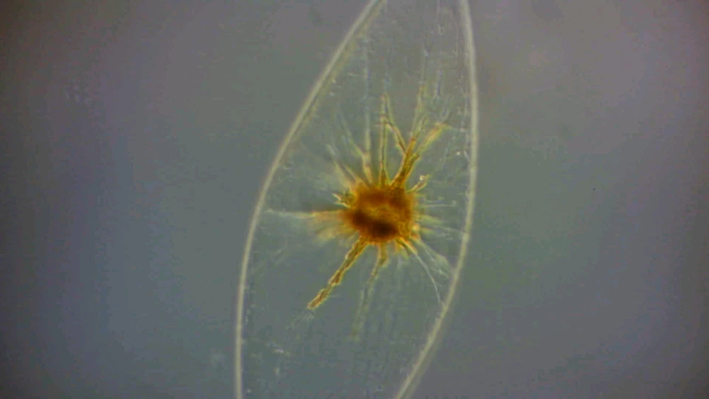 Image uploaded by Sinson