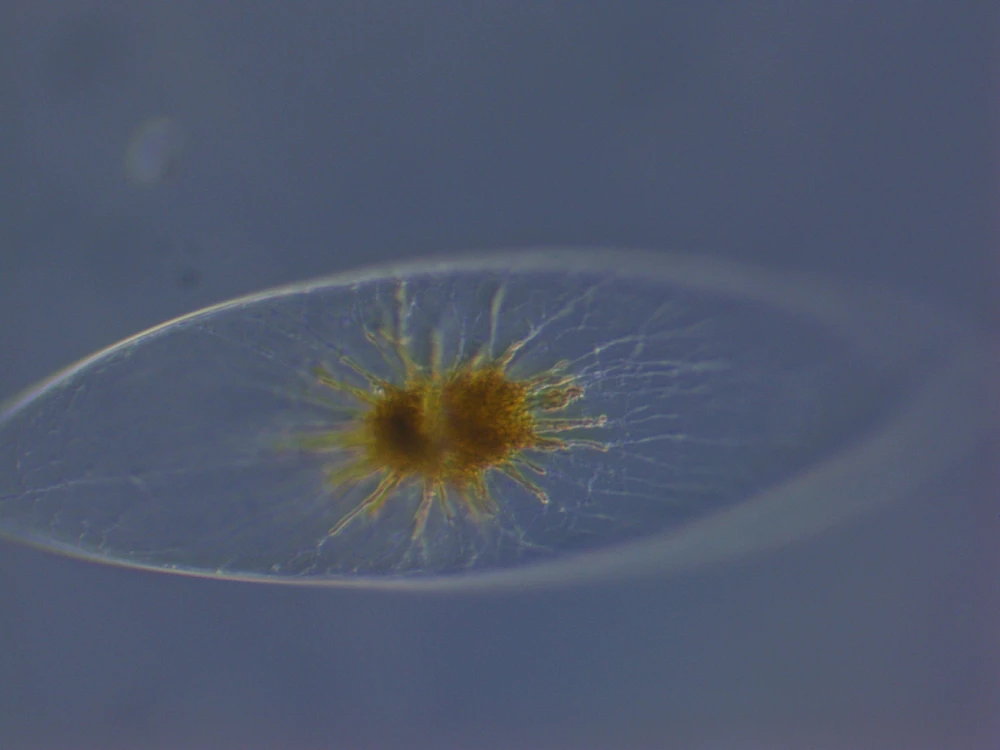 Image uploaded by Sinson