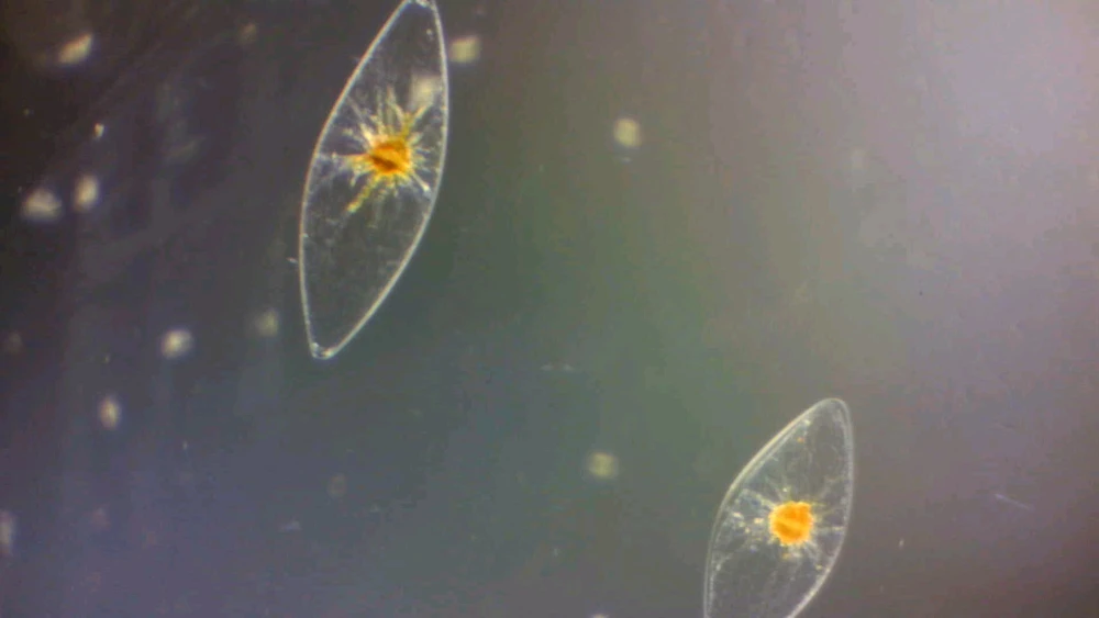 Image uploaded by Sinson