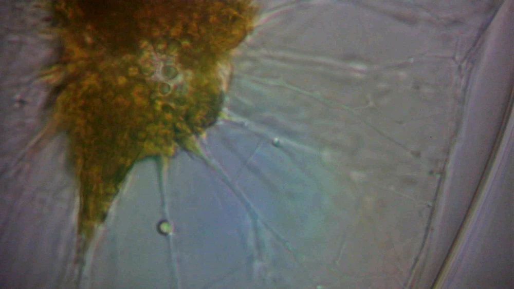 Image uploaded by Sinson