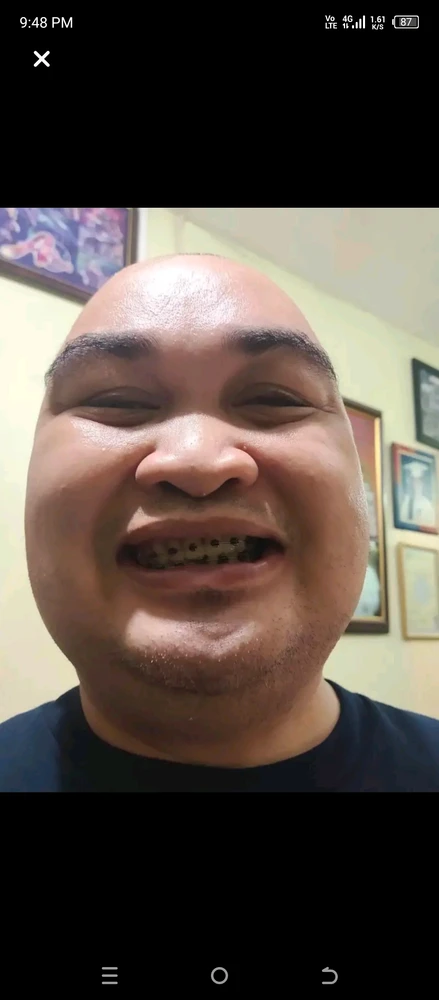 Duab xa los ntawm Attorney John eley Louis castillo