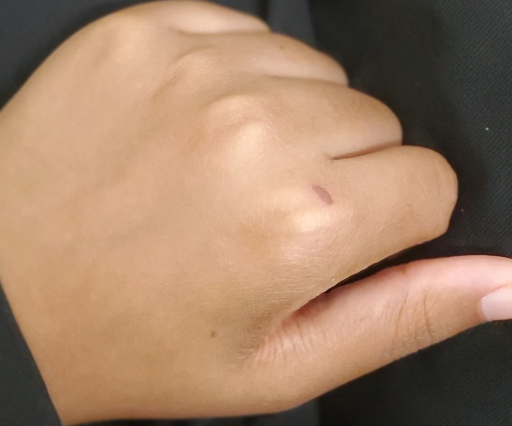 Image uploaded by Angel