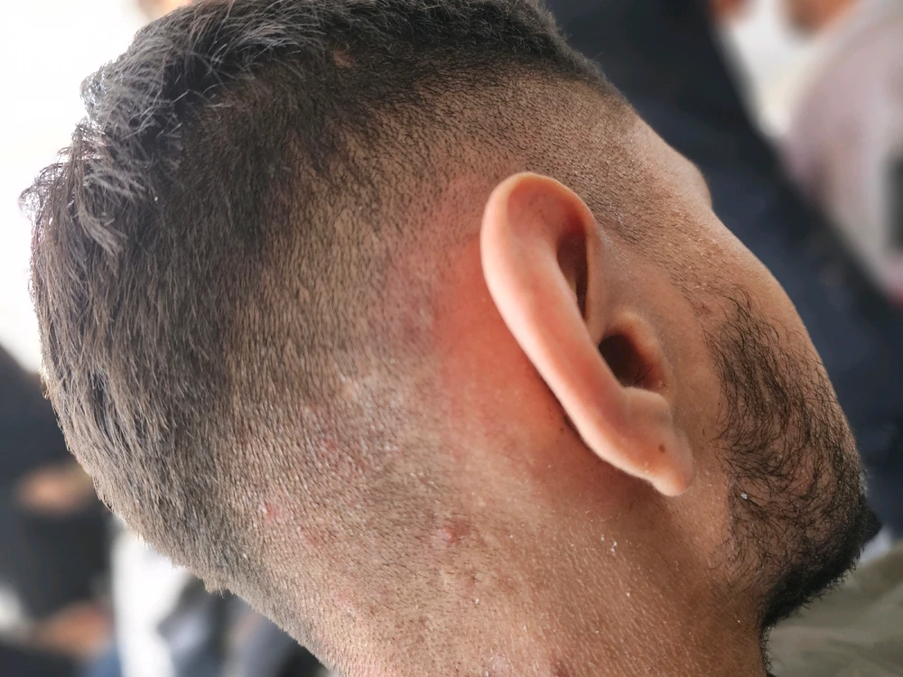 Imagen subida por Ángel