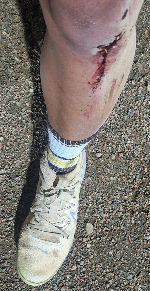 Semifinals in softball