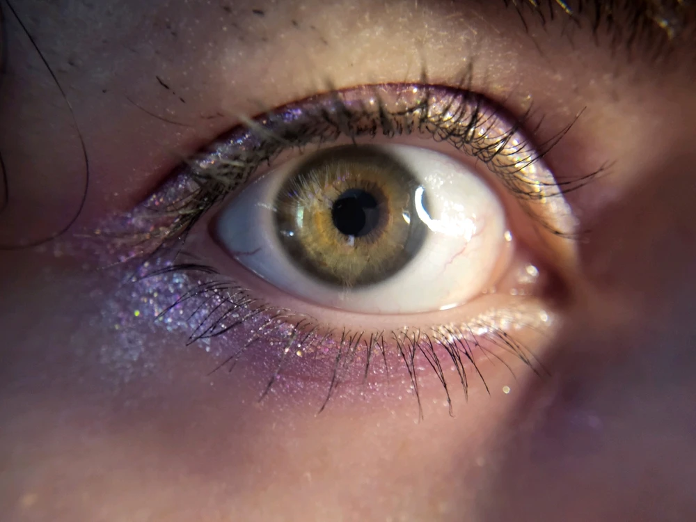 Image uploaded by Moony