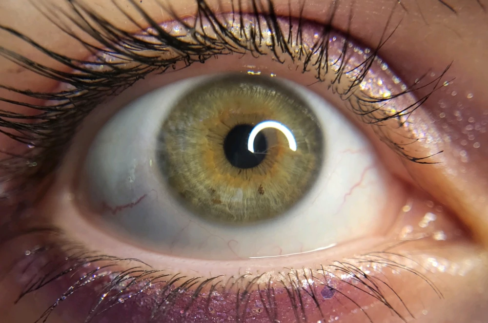 Image uploaded by Moony