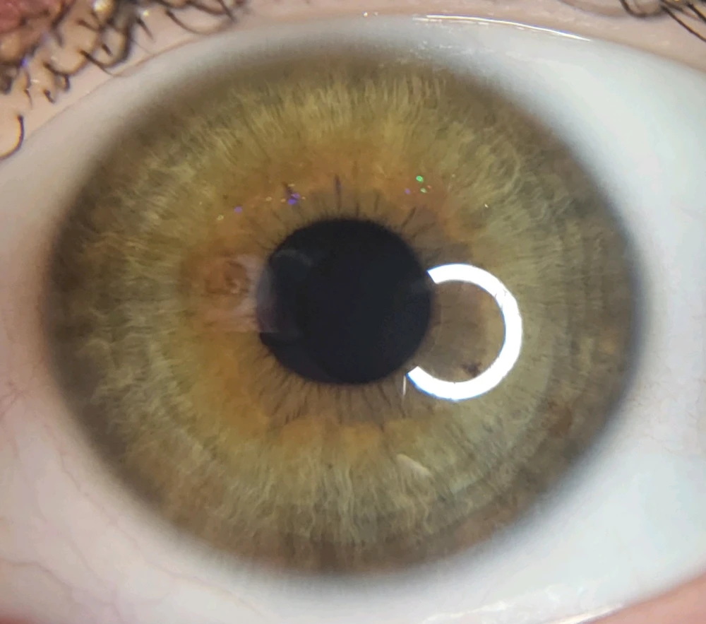 Image uploaded by Moony