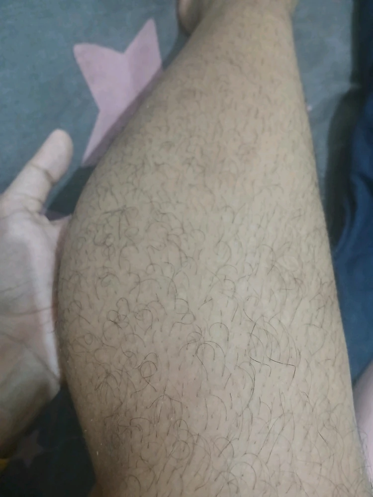 Will someone ever love me even when i have this hairy leg ? I mean sometimes i shave but they grow so fast in just less than 5 days. It's honestly genetic but sometimes i feel insecure no one will ever love me just bcs of this thing and they would think it's not normal or something