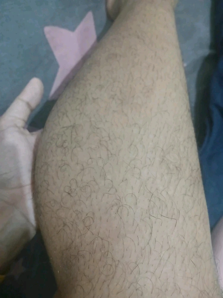 Will someone ever love me even when i have this hairy leg ? I mean sometimes i shave but they grow so fast in just less than 5 days. It's honestly genetic but sometimes i feel insecure no one will ever love me just bcs of this thing and they would think it's not normal or something