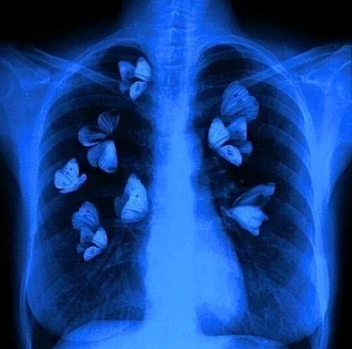 Image uploaded by Mikalob