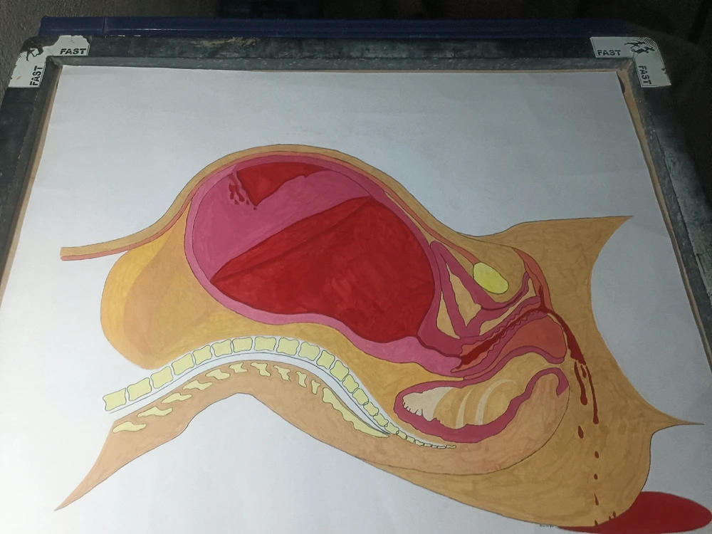 Image uploaded by Albin