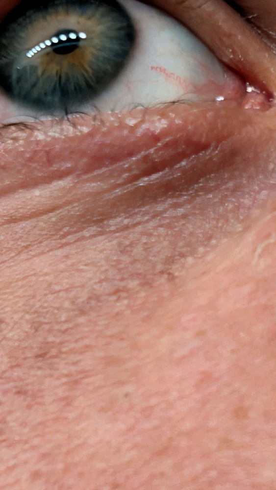 Image uploaded by Joseph