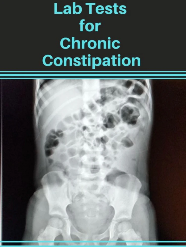 Image uploaded by Erika