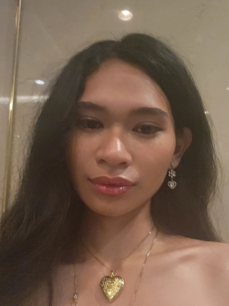 Image uploaded by Ranela