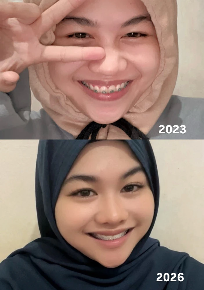 Dey پاران اپ لوڊ ٿيل GIF