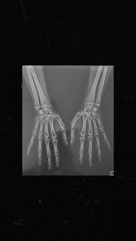 GIF uploaded by Meraxes
