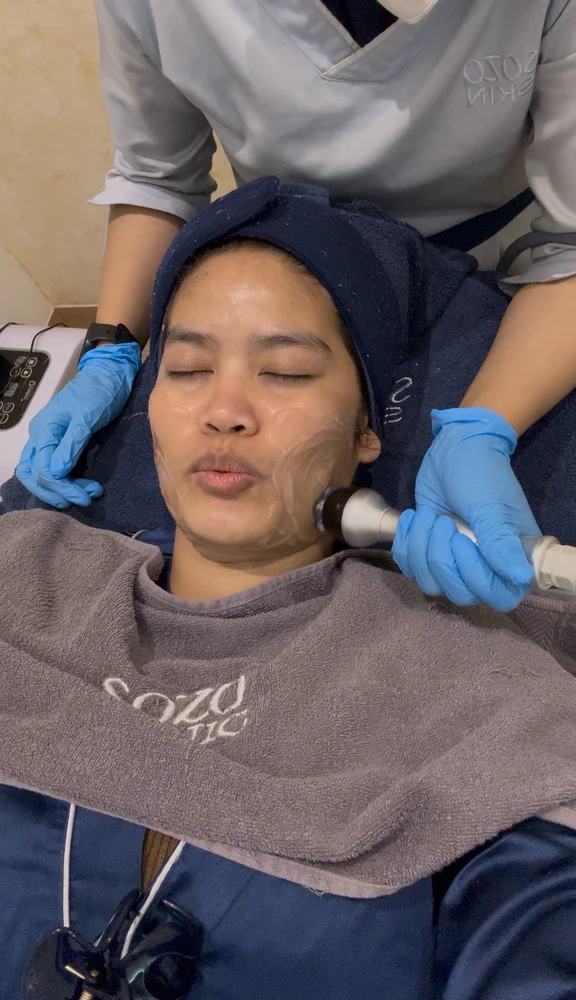 I-upload ni Apia ang larawan