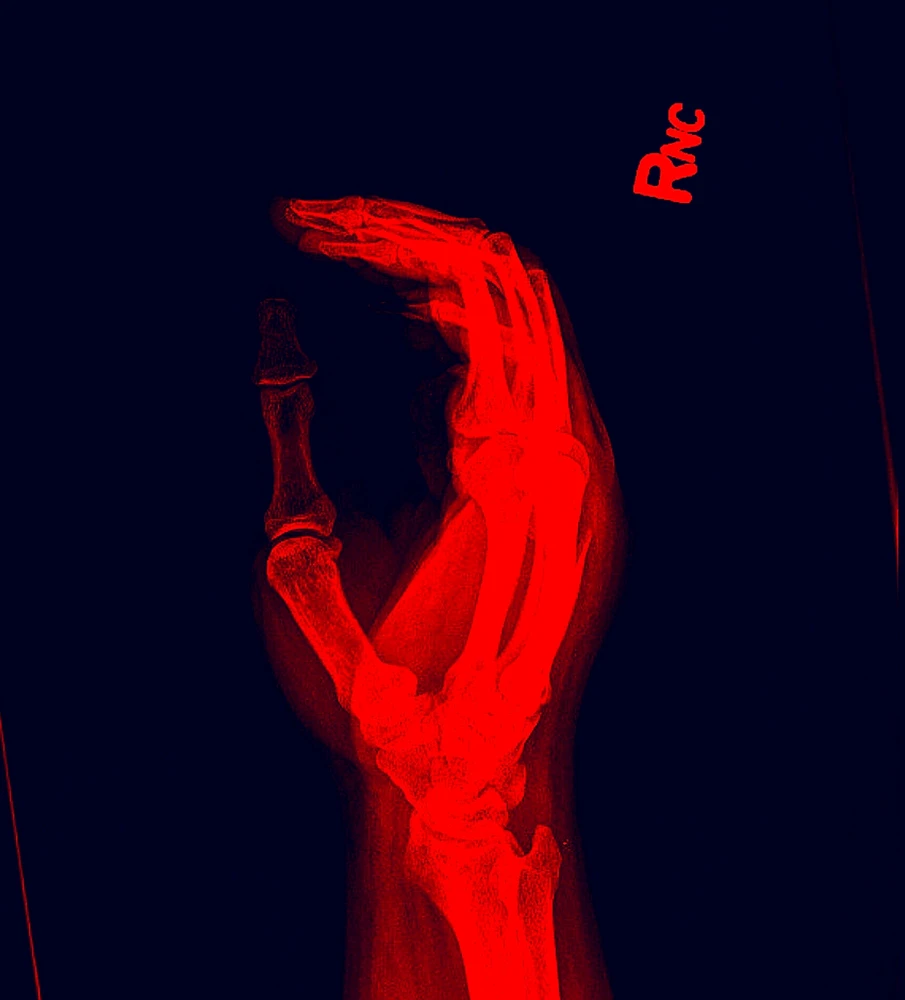 Brandon байршуулсан GIF